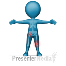 Custom Figure Pain Spot PowerPoint animation