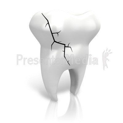 Cracked Tooth Presentation clipart
