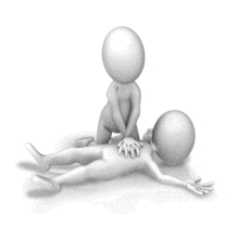 An animation of a someone giving CPR chest compressions to a person.