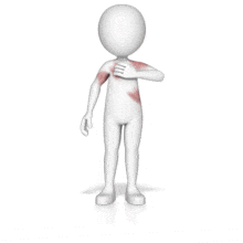 This animation shows a figure itching red areas on skin.