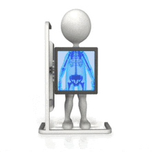 A 3D stick figure stands behind a body scanner and his skeleton and bones are visible on the monitor.