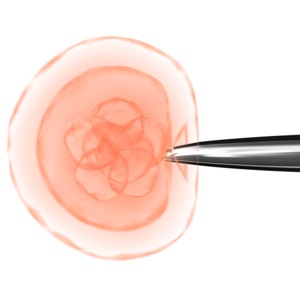 A tip of a needle is inserted into a living cell.