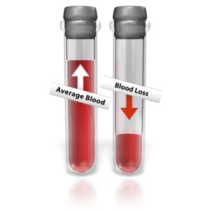 An image of two blood test tubes one showing average blood &amp; the other blood loss.