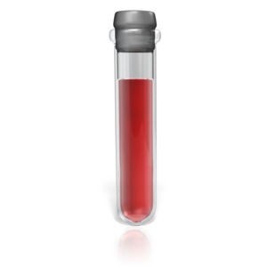 An image of a test tube with a full blood volume.