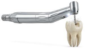 Download this Presentation Clipart illustrating dental technology and tooth repair.
