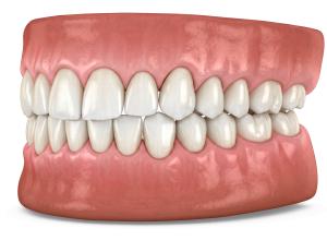 Download this Presentation Clipart featuring a detailed profile of teeth and gums for educational use.