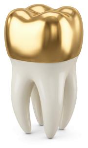 Download this Presentation Clipart featuring a gold tooth crown for dental health visuals.