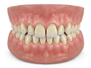 Download this Presentation Clipart to illustrate dental hygiene and health topics effectively.