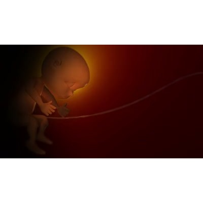 This video shows an unborn baby in the mothers whom.