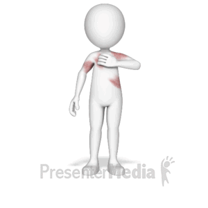 Figure with Itchy Rash | 3D Animated Clipart for PowerPoint -  
